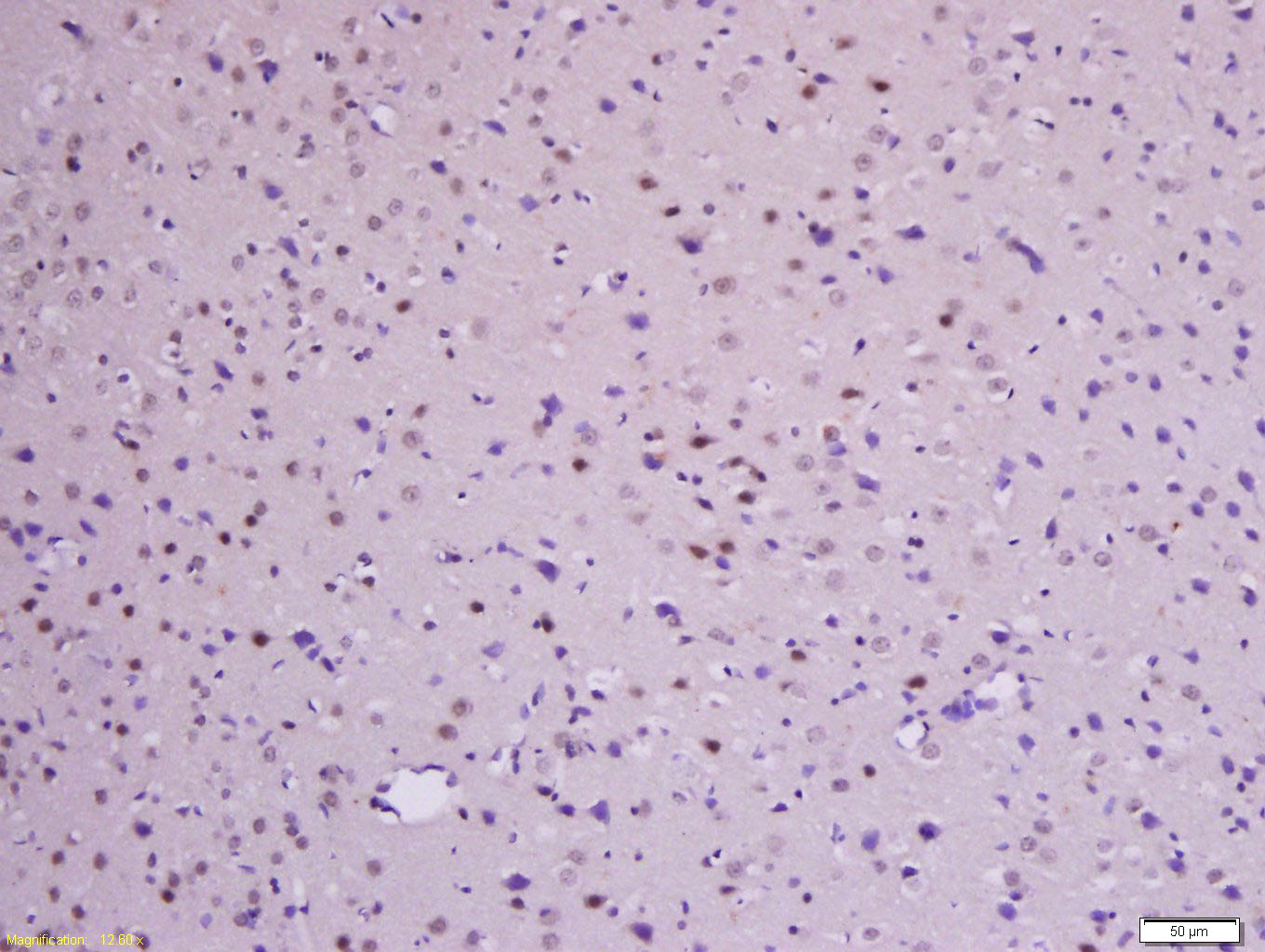 Rabbit anti-Phospho-β-Catenin(Ser33+Ser37) Polyclonal Antibody