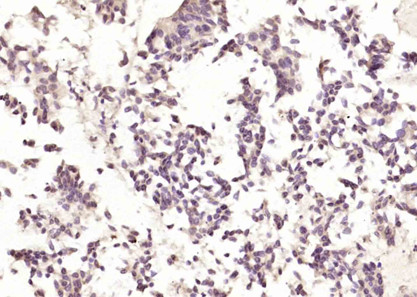 Rabbit anti-Phospho-Bcl-2(Ser70) Polyclonal Antibody