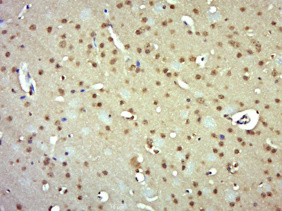 Rabbit anti-E2F1 Polyclonal Antibody