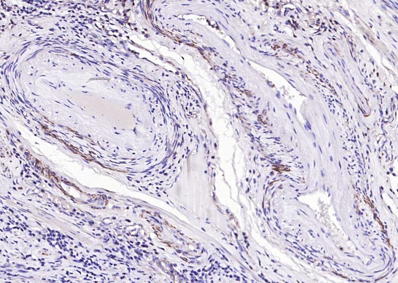 Rabbit anti-α Smooth Muscle Actin Polyclonal Antibody