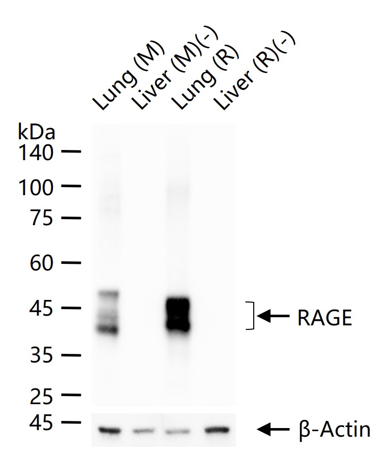 Rabbit anti-RAGE Monoclonal Antibody