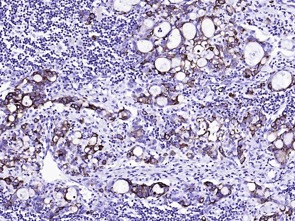 Rabbit anti-CK20 Monoclonal Antibody