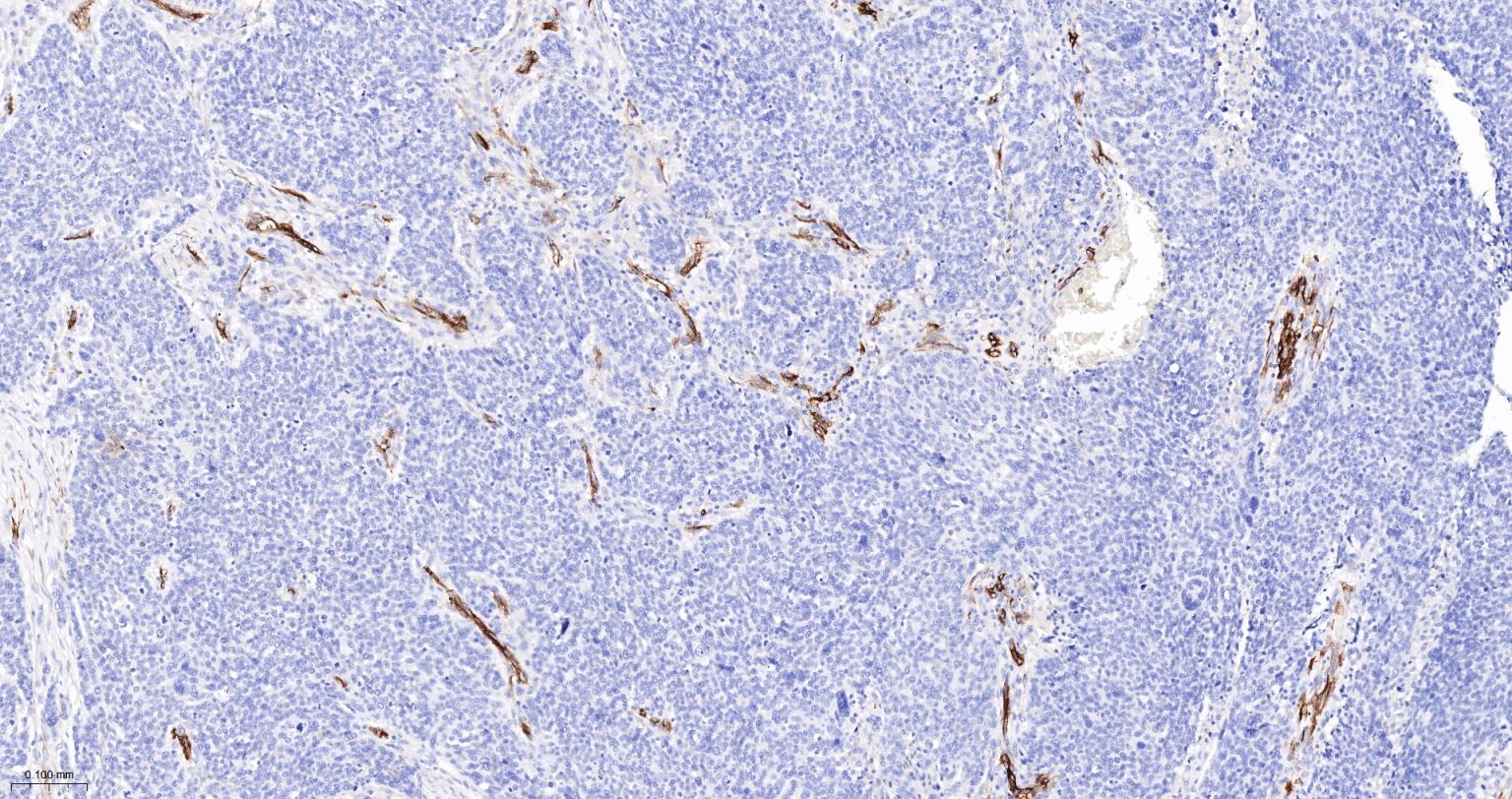 Rabbit anti-CD105 Polyclonal Antibody
