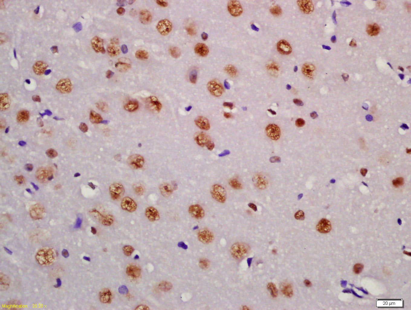 Rabbit anti-Phospho-PTEN(Ser380+Thr382+Thr383) Polyclonal Antibody