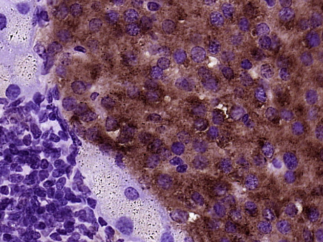 Rabbit Anti-BTBD17 Polyclonal Antibody