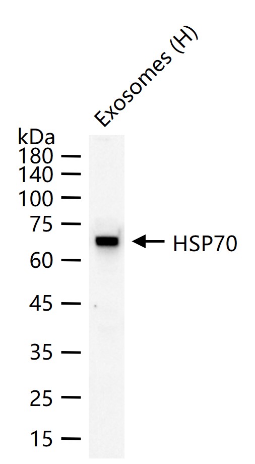 Rabbit anti-HSP70 Monoclonal Antibody