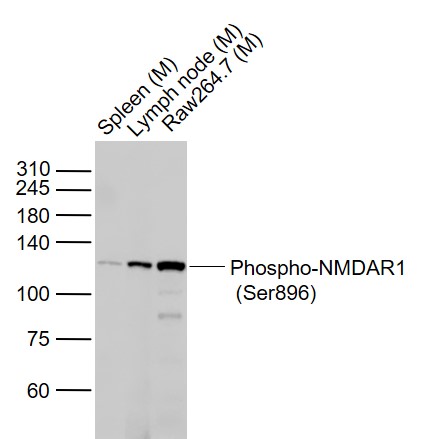 Rabbit anti-Phospho-NMDAR1(Ser896) Polyclonal Antibody