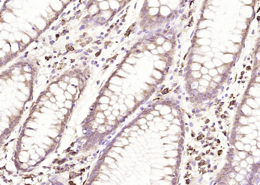 Rabbit anti-VEGF-C Polyclonal Antibody