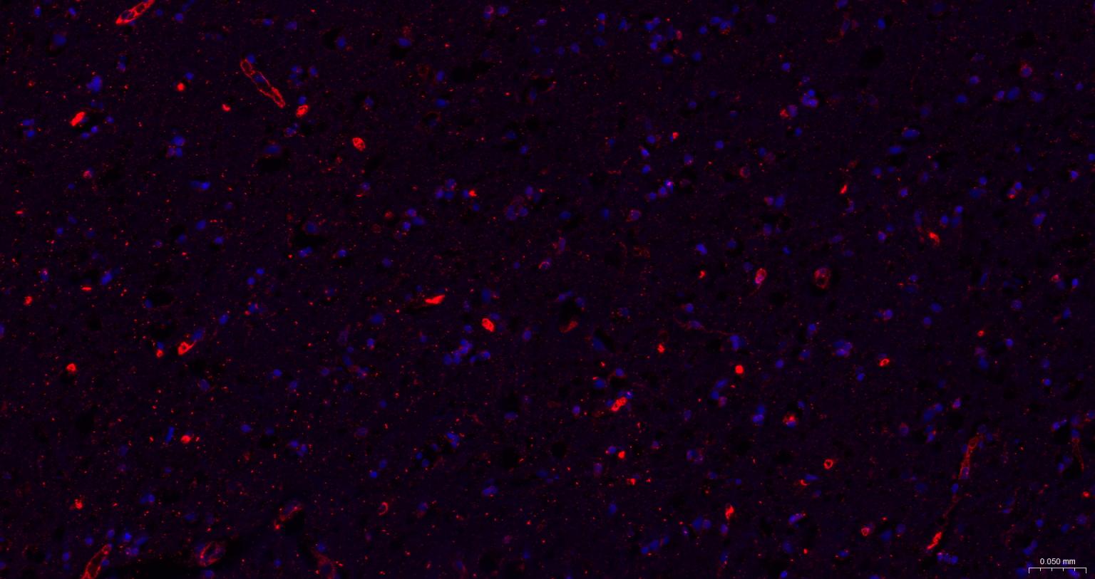 Rabbit anti- BDNF Monoclonal Antibody