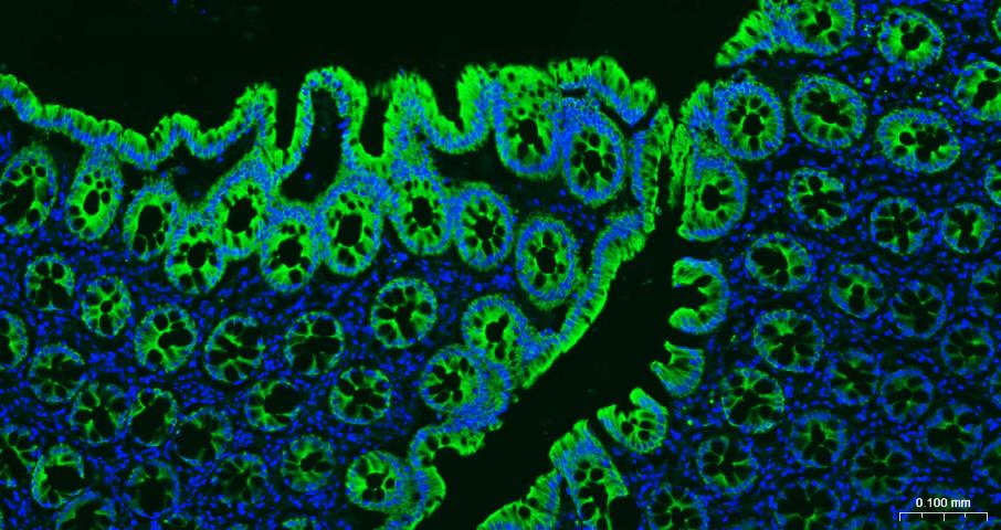 Mouse anti-Cytokeratin 19 Monoclonal Antibody