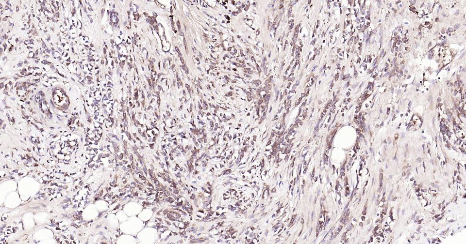 Rabbit anti-Bax Monoclonal Antibody