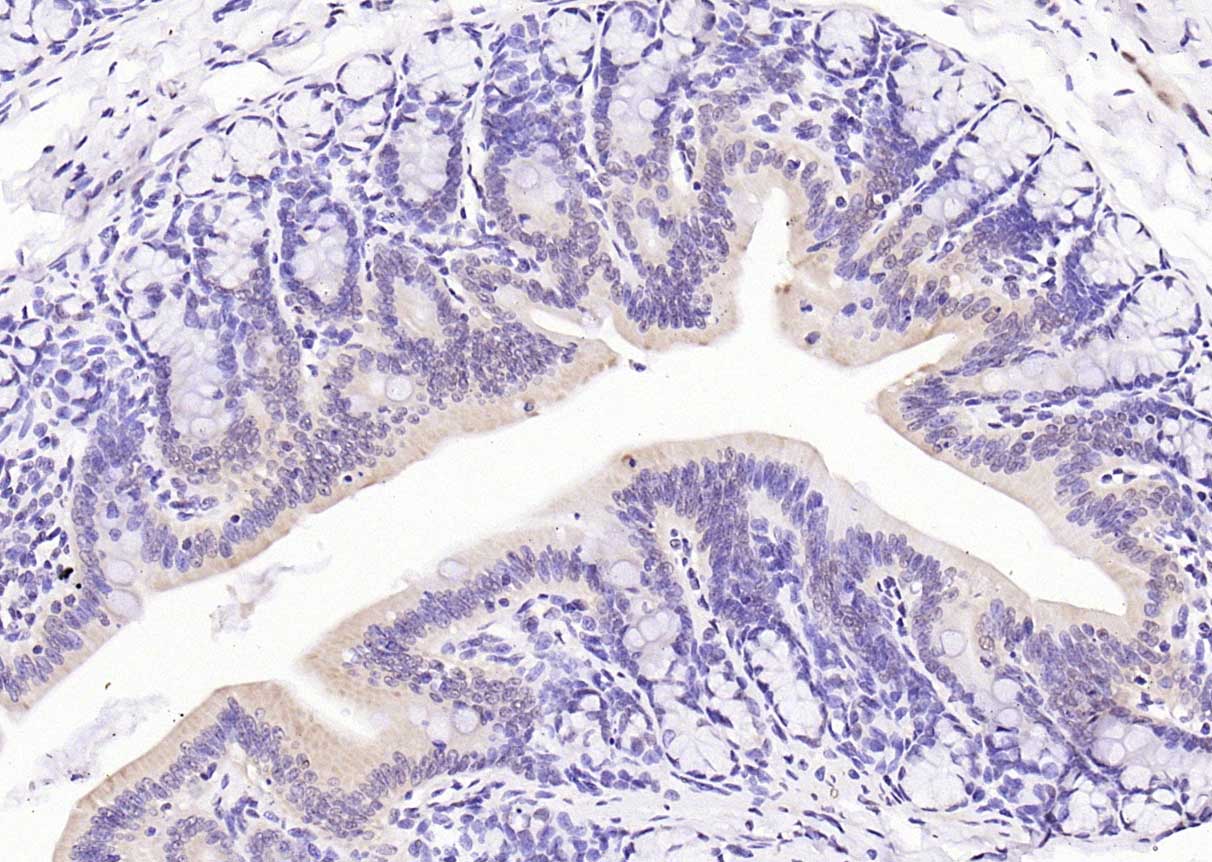 Rabbit anti-Phospho-PI3 Kinase p110 β(Ser1070) Polyclonal Antibody