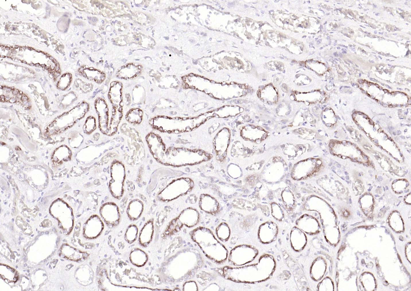 Rabbit anti-TNFR1  Polyclonal Antibody