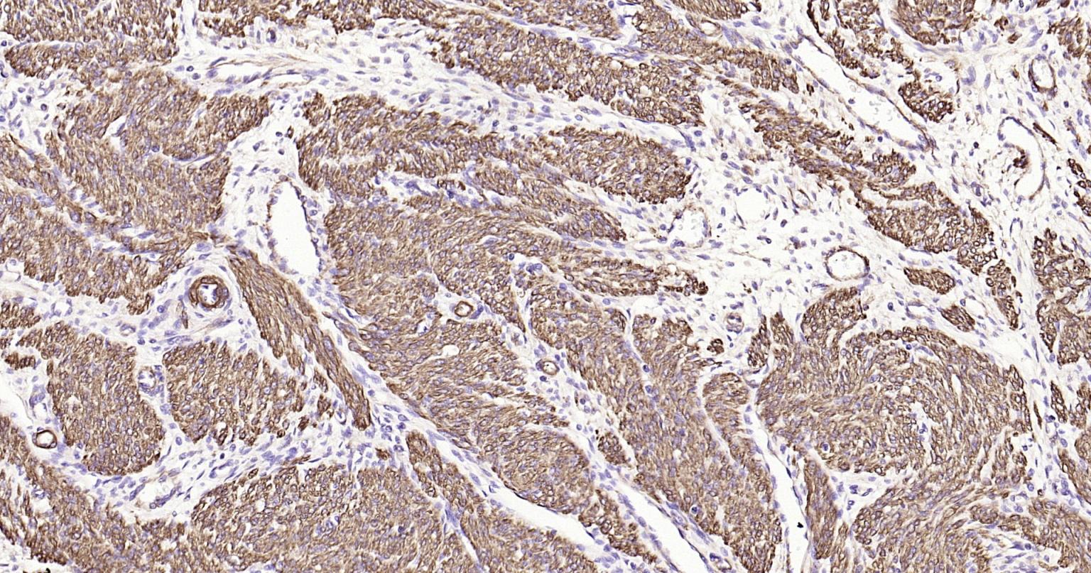 Rabbit anti-α Smooth Muscle Actin Monoclonal Antibody