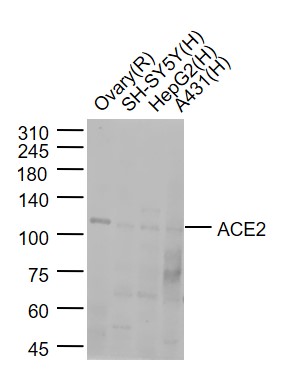 Rabbit anti-ACE2 Polyclonal Antibody