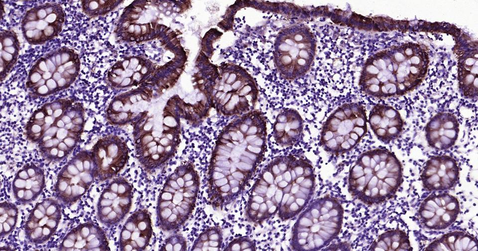Mouse anti-Cytokeratin 19 Monoclonal Antibody
