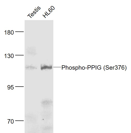 Rabbit anti-Phospho-PPIG(Ser376) Polyclonal Antibody