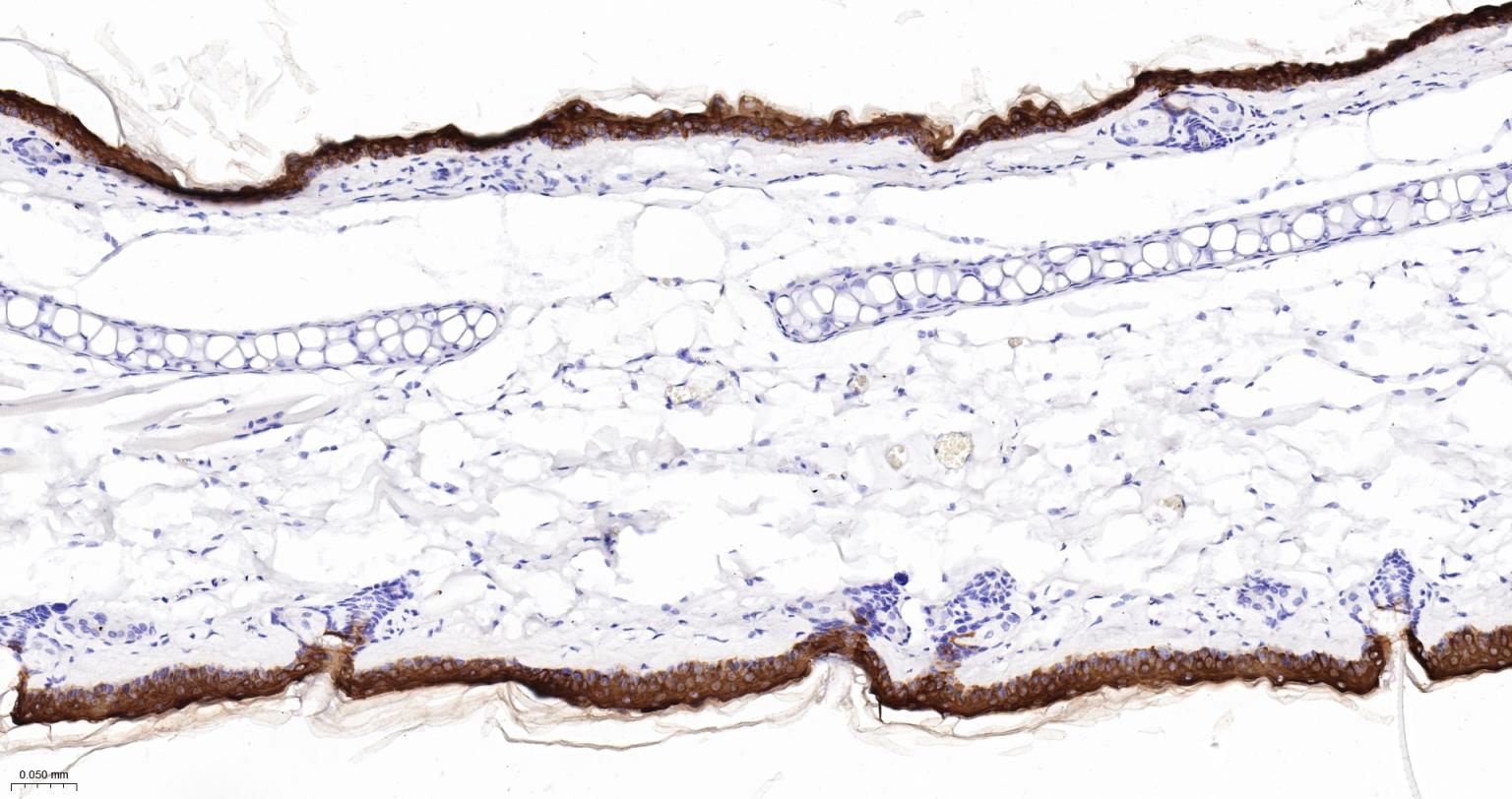 Rabbit anti-CK10/Cytokeratin 10 Monoclonal Antibody
