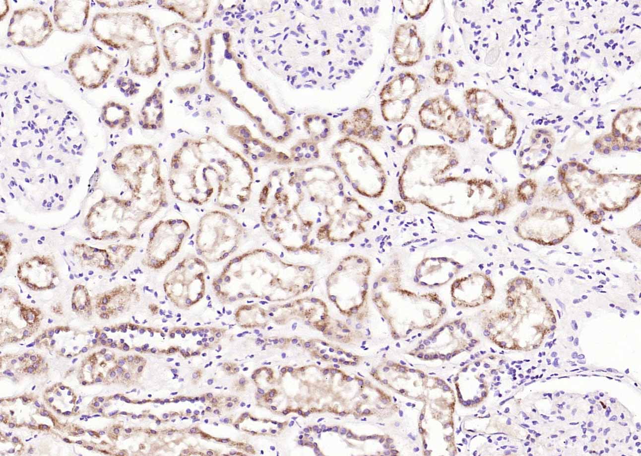 Rabbit Anti-MARCH6 Polyclonal Antibody