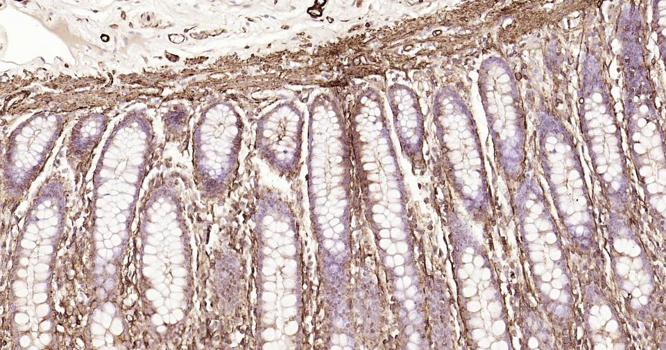 Rabbit anti-α Smooth Muscle Actin Monoclonal Antibody