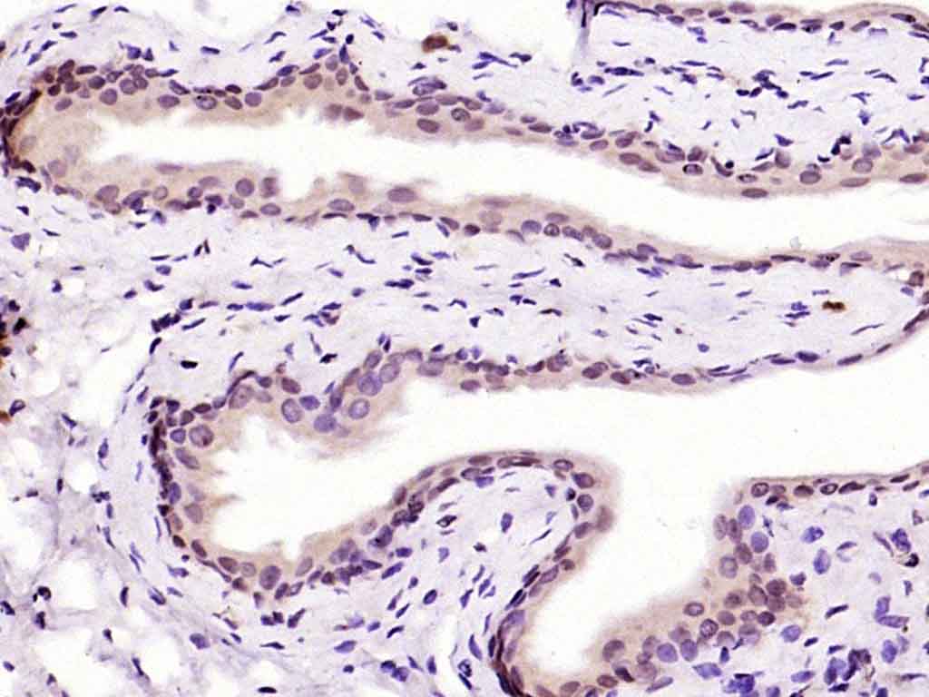 Rabbit anti-HMG4 Polyclonal Antibody