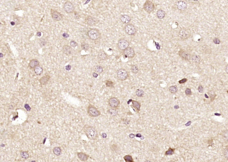 Rabbit anti-DRP2 Polyclonal Antibody