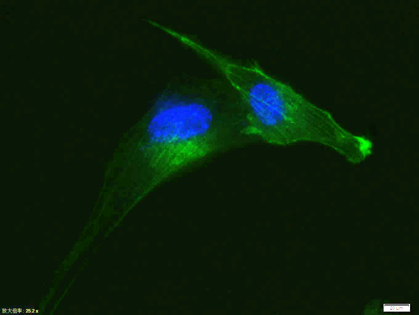 Rabbit anti-α Smooth Muscle Actin Monoclonal Antibody