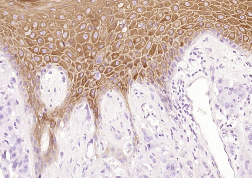 Rabbit anti-Cytokeratin 2e Monoclonal Antibody