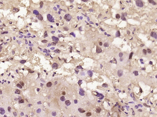 Rabbit anti-Phospho-CK18(Ser52) Polyclonal Antibody