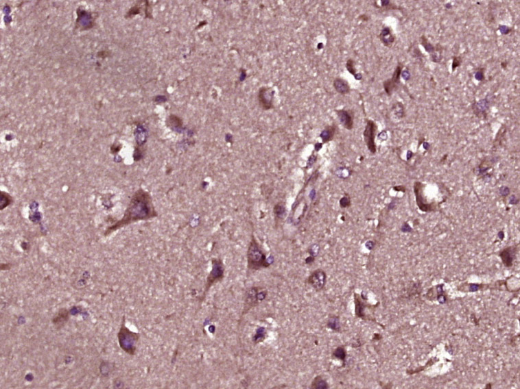Rabbit anti-Phospho-PKC δ(Ser645) Polyclonal Antibody
