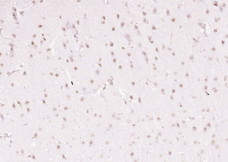 Rabbit Anti-LRRC41 Polyclonal Antibody