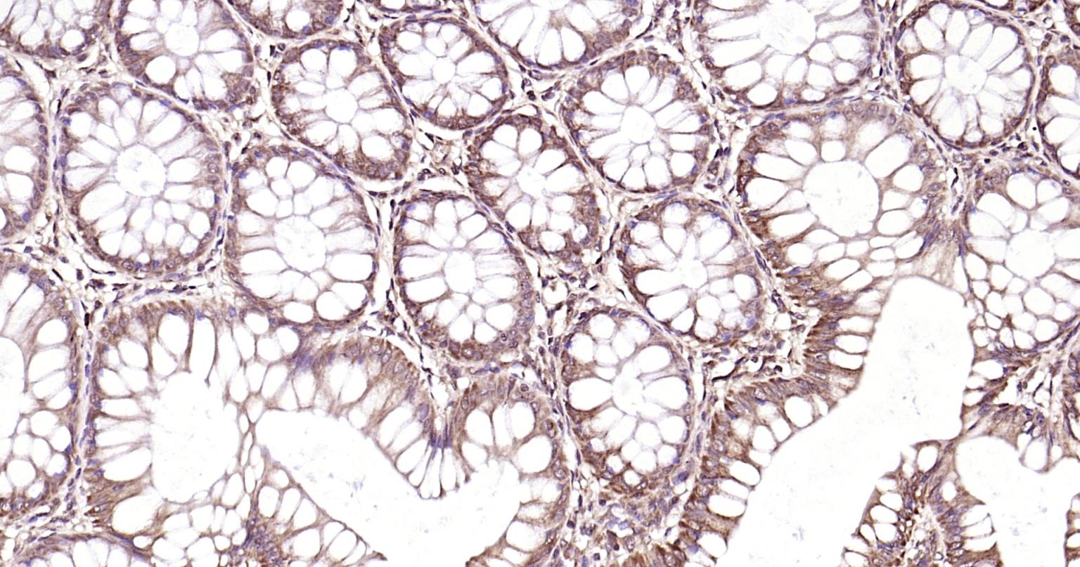 Rabbit anti-Beclin 1 Polyclonal Antibody