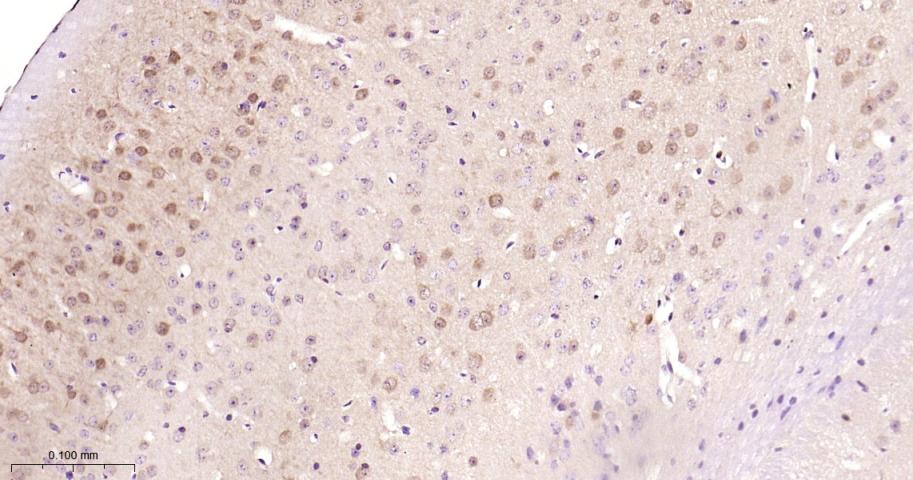 Rabbit anti-HSP70 Monoclonal Antibody