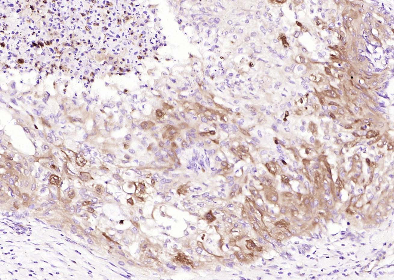 Rabbit Anti-MARCH6 Polyclonal Antibody
