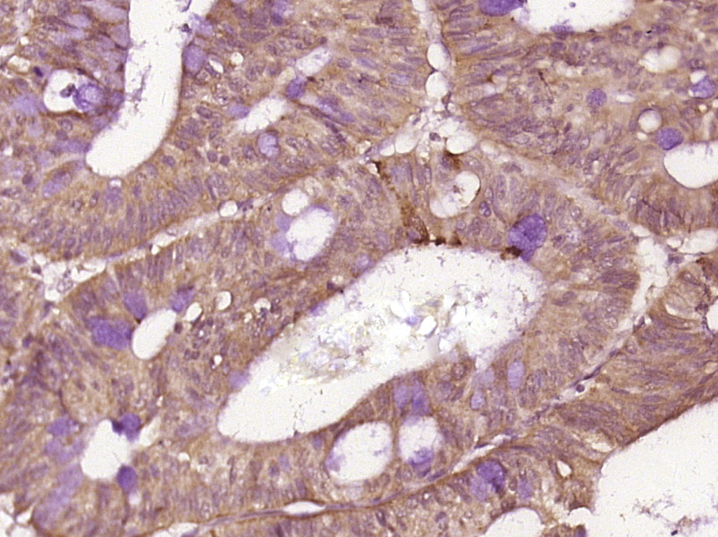 Rabbit anti-Phospho-IRAK1(Thr209) Polyclonal Antibody
