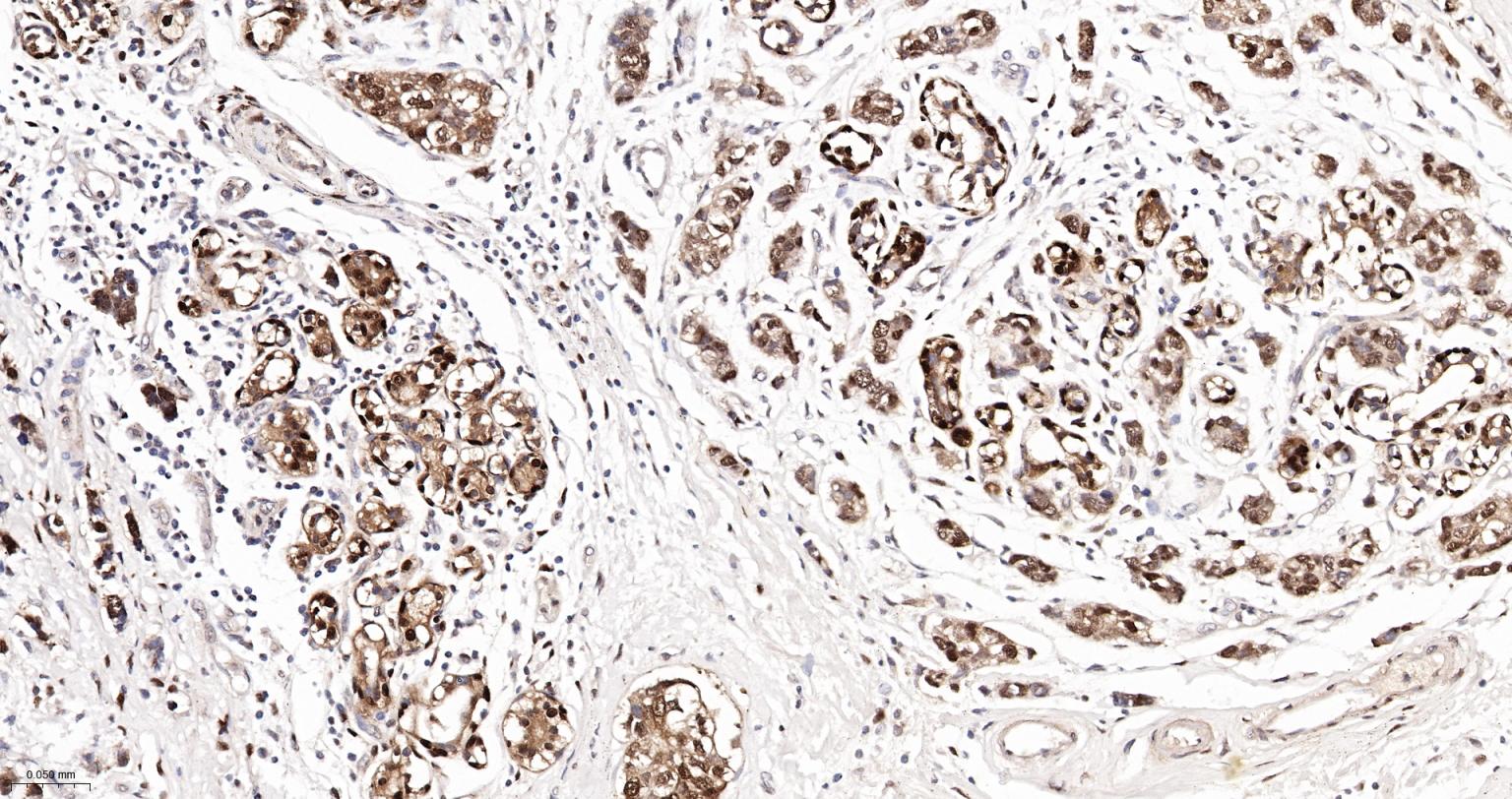 Rabbit anti-HSP70 Monoclonal Antibody