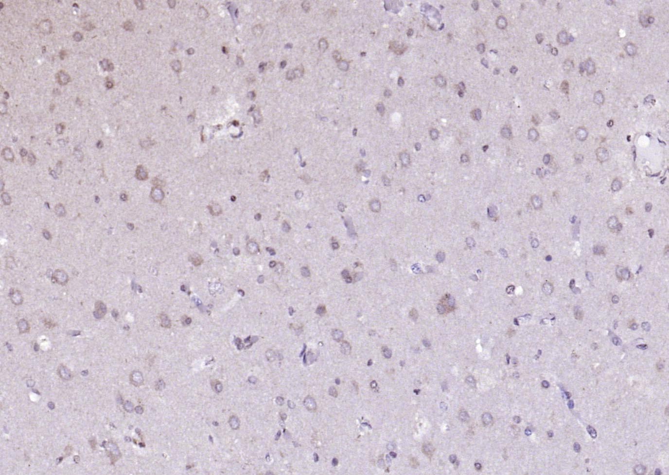 Rabbit anti-ANKRD54 Polyclonal Antibody