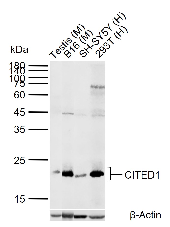 Rabbit Anti-CITED1 Polyclonal Antibody