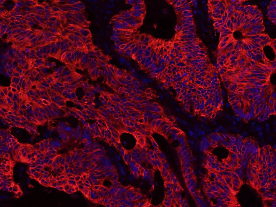 Mouse anti-Cytokeratin 8 Monoclonal Antibody