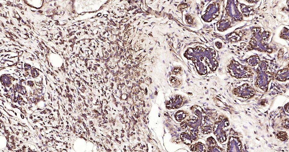 Rabbit anti-α Smooth Muscle Actin Monoclonal Antibody