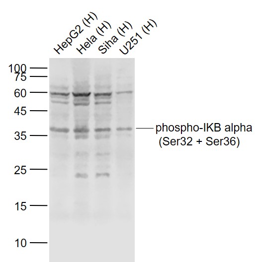Rabbit anti-Phospho-IKB α(Ser32+Ser36) Polyclonal Antibody