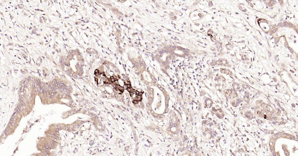 Rabbit anti-Stat3 Monoclonal Antibody