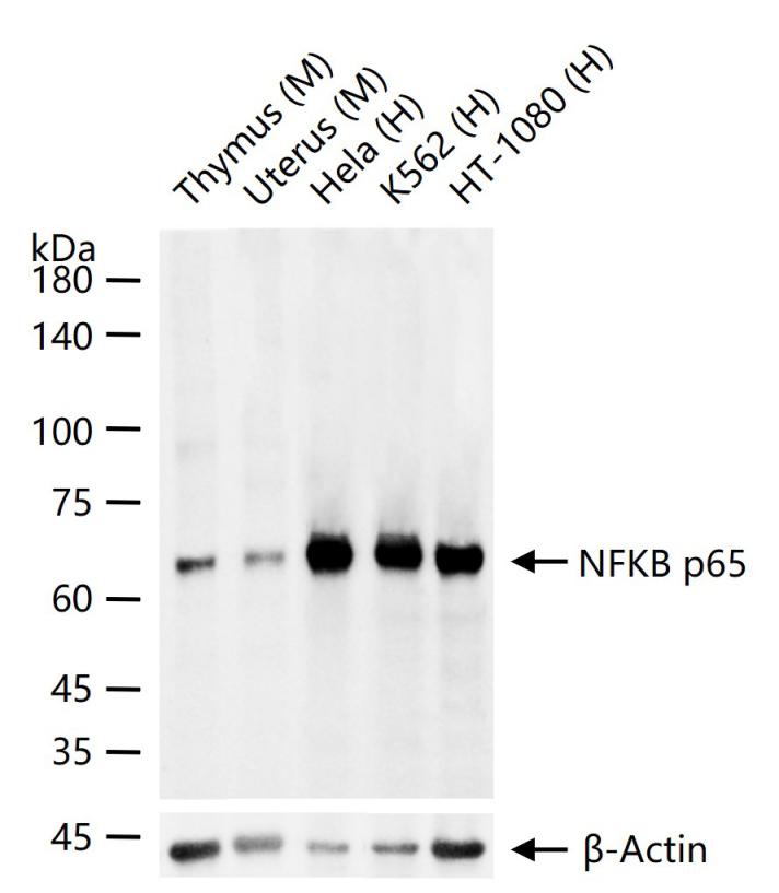 Rabbit anti-NFKB p65 Monoclonal Antibody
