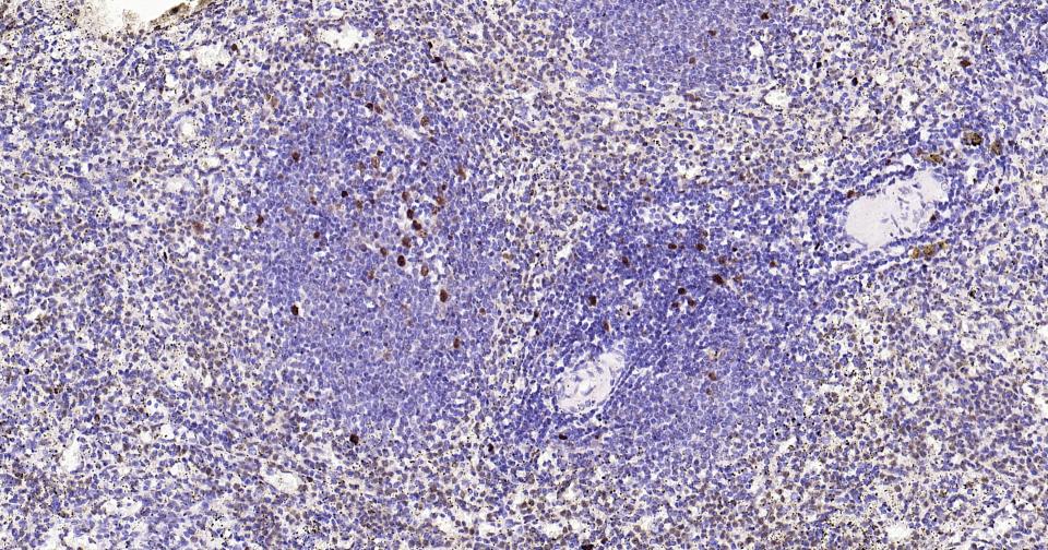 Rabbit anti-PCNA(Nuclear Loading Control) Monoclonal Antibody