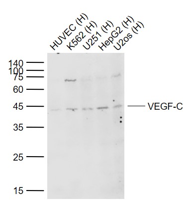 Rabbit anti-VEGF-C Polyclonal Antibody