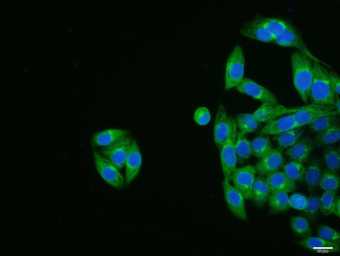 Mouse anti-Cytokeratin 19 Monoclonal Antibody