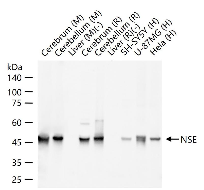 Rabbit anti-NSE Polyclonal Antibody