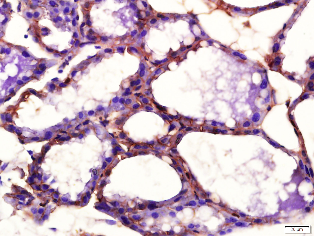 Rabbit anti-Phospho-PDGFRA(Tyr754) Polyclonal Antibody