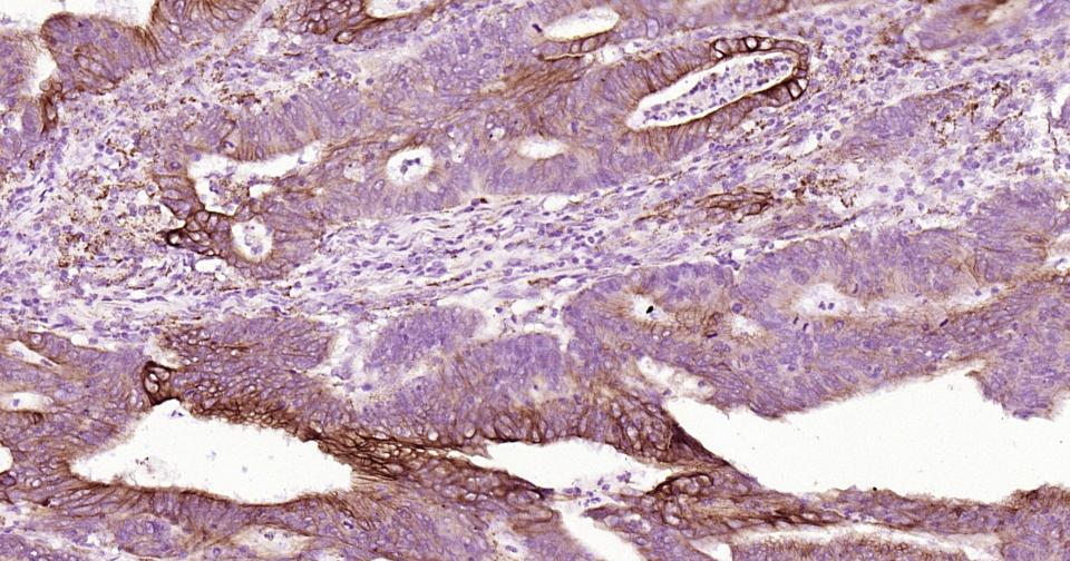 Mouse anti-Cytokeratin 19 Monoclonal Antibody