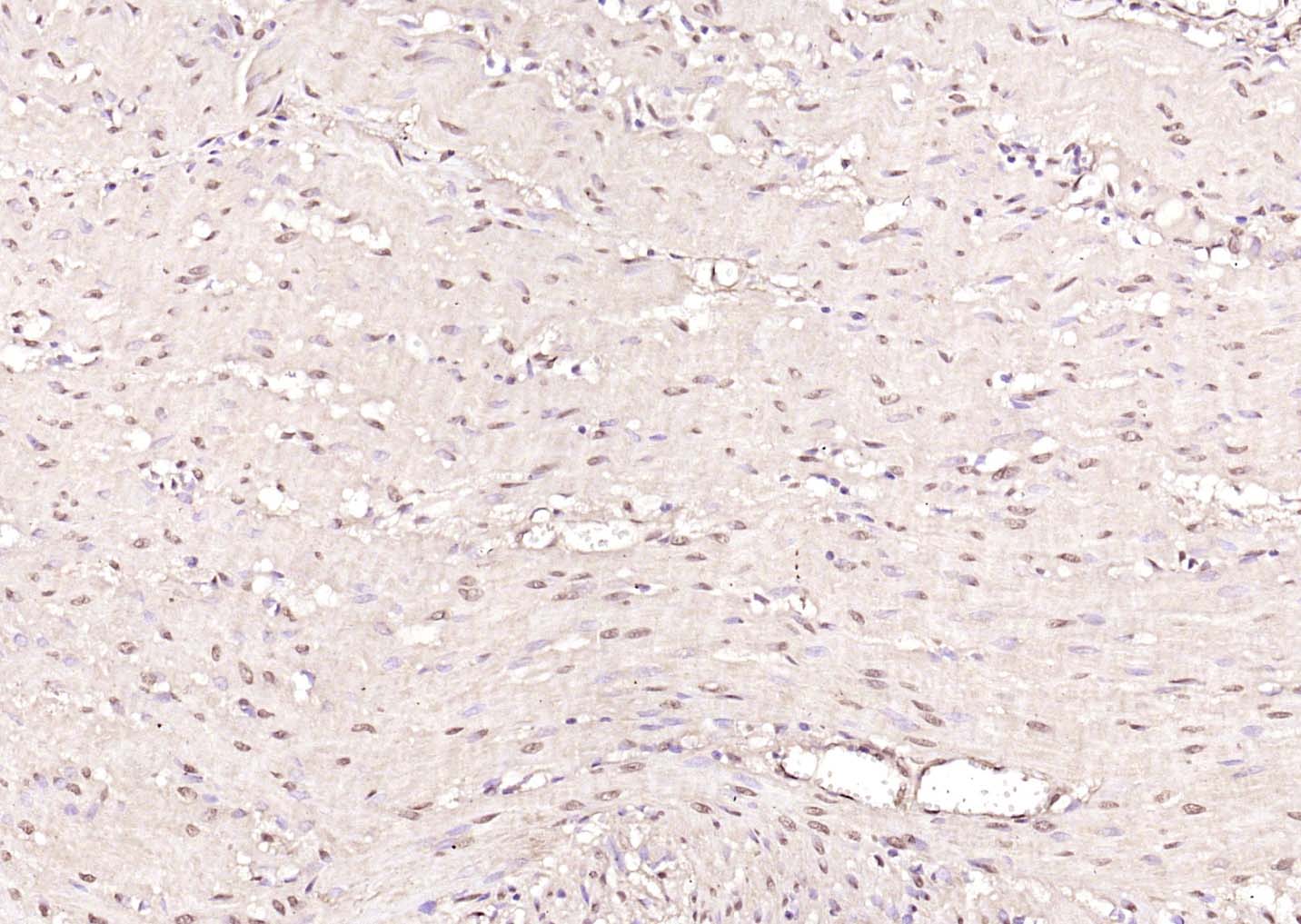 Rabbit anti-Proteasome 20S α1 Polyclonal Antibody